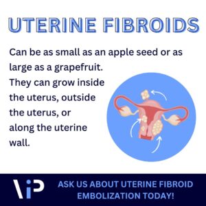 vip uterine fibroids 300x300